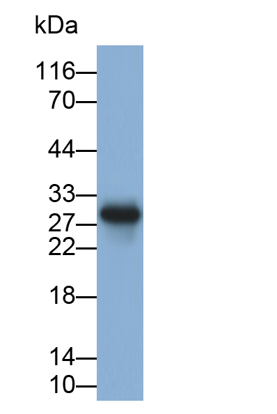 白介素35(IL35)單克隆抗體