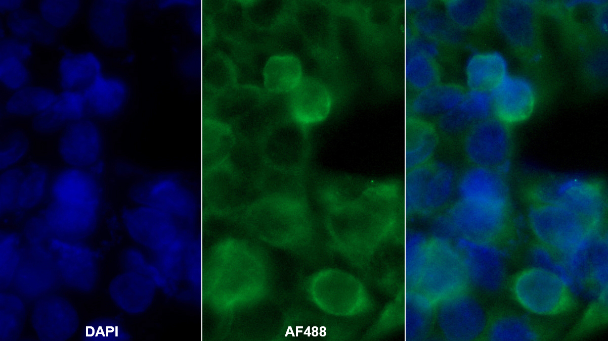 絲氨酸蛋白酶抑制劑A10(SERPINA10)單克隆抗體
