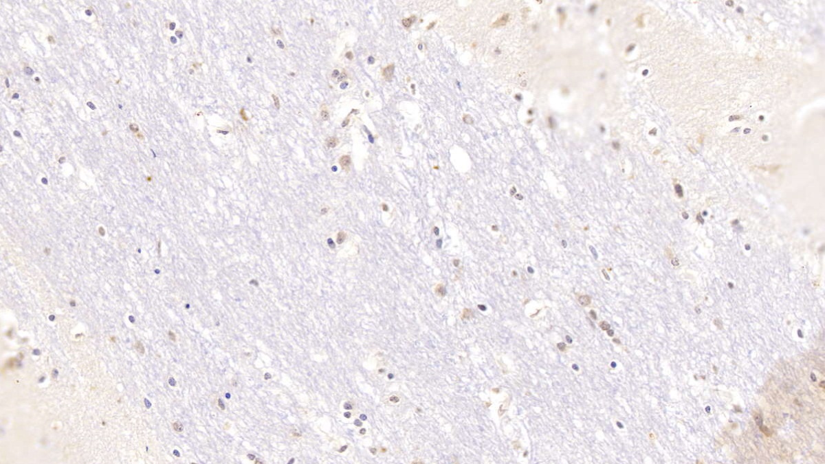 絲氨酸蛋白酶抑制劑A10(SERPINA10)單克隆抗體