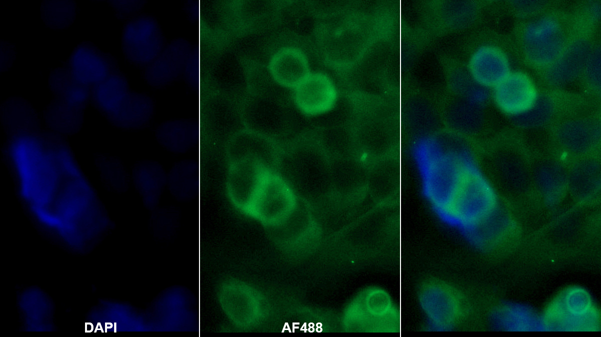 絲氨酸蛋白酶抑制劑A10(SERPINA10)單克隆抗體