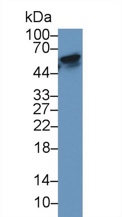 核因子κB受體激活因子(RANk)單克隆抗體