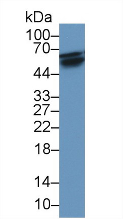 核因子κB受體激活因子(RANk)單克隆抗體