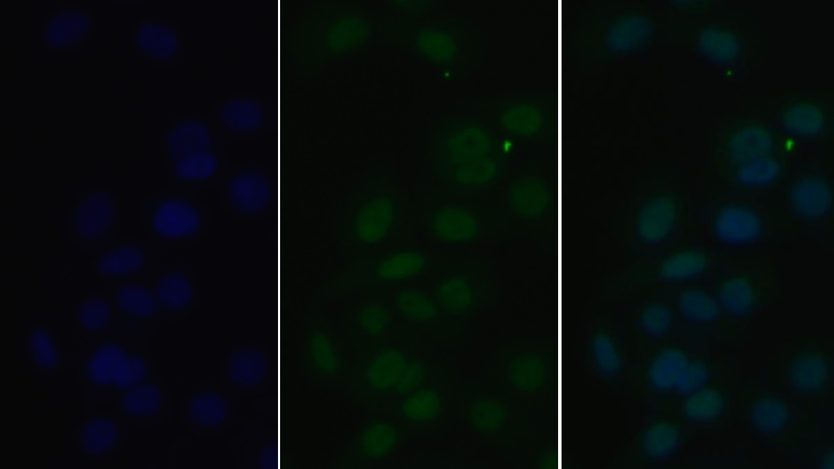 组蛋白脱乙酰基酶1(HDAC1)单克隆抗体