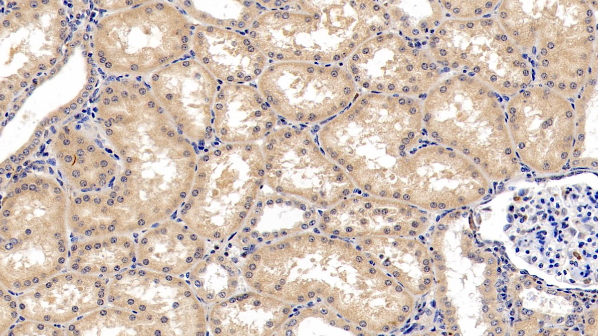 离子化钙结合适配分子1(AIF1)单克隆抗体