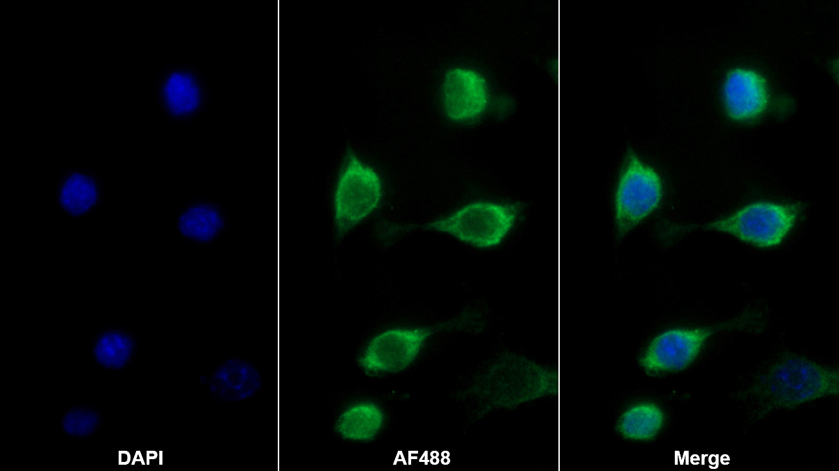 离子化钙结合适配分子1(AIF1)单克隆抗体
