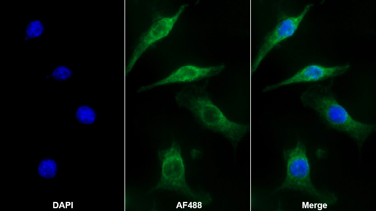 离子化钙结合适配分子1(AIF1)单克隆抗体