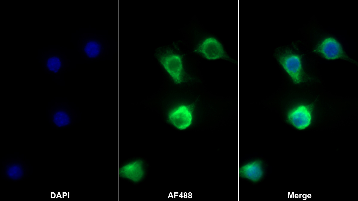 离子化钙结合适配分子1(AIF1)单克隆抗体