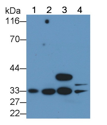 胱天蛋白酶6(CASP6)單克隆抗體