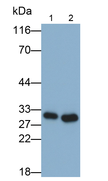 羰基還原酶1(CBR1)單克隆抗體