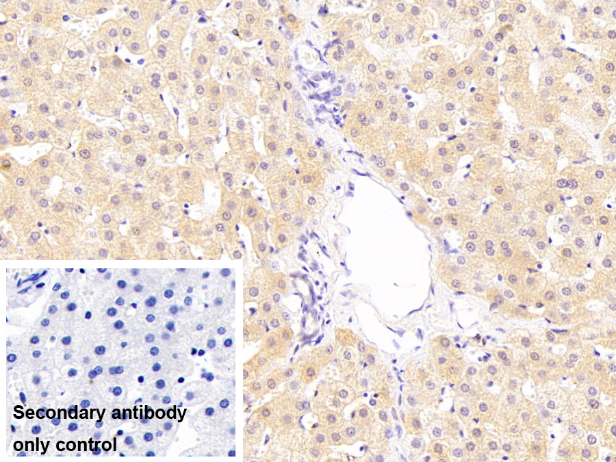 羰基還原酶1(CBR1)單克隆抗體