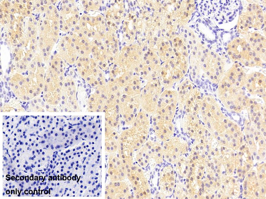 羰基還原酶1(CBR1)單克隆抗體