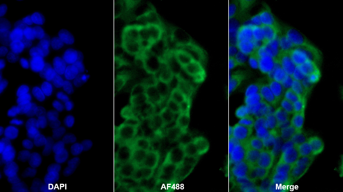膜鐵轉(zhuǎn)運(yùn)蛋白(FPN)單克隆抗體