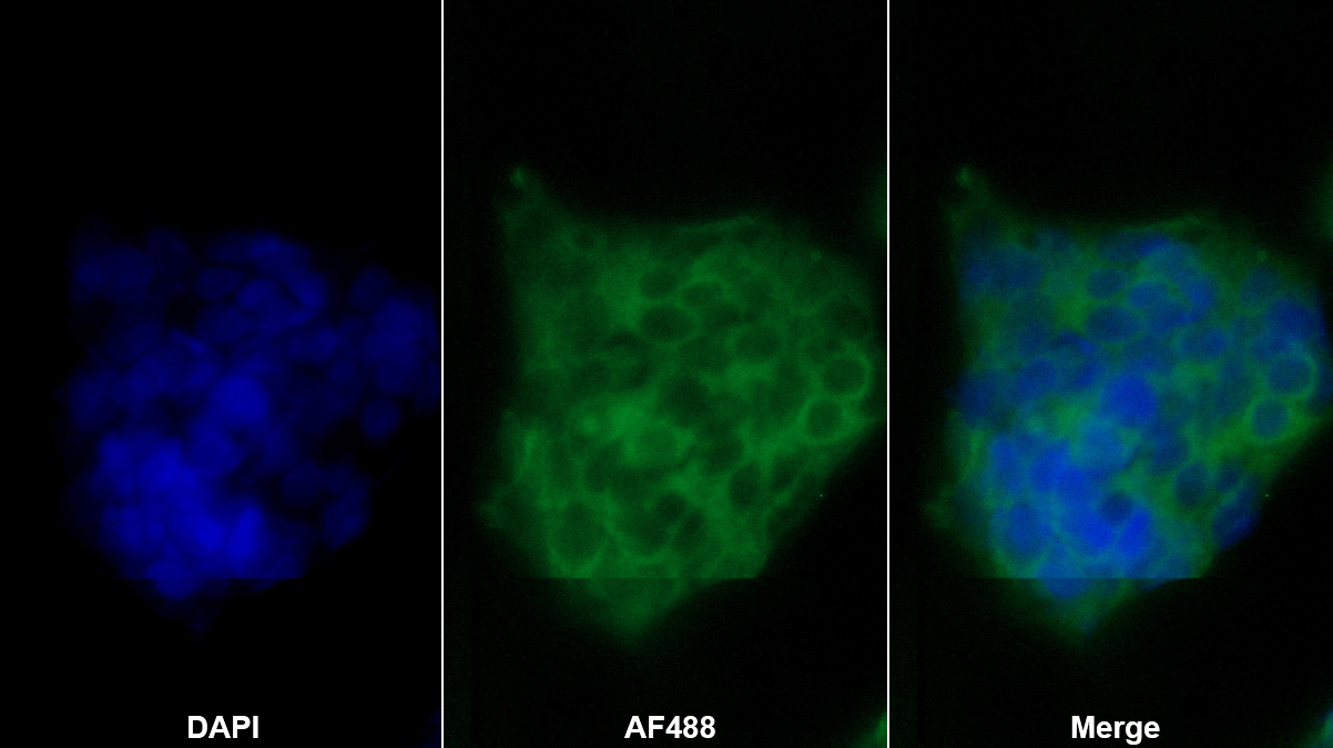 膜鐵轉(zhuǎn)運(yùn)蛋白(FPN)單克隆抗體