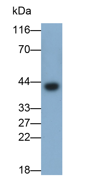 腫瘤易感基因101(TSG101)單克隆抗體