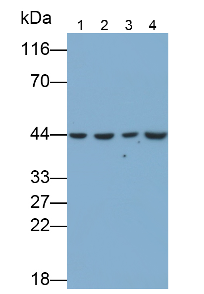 腫瘤易感基因101(TSG101)單克隆抗體