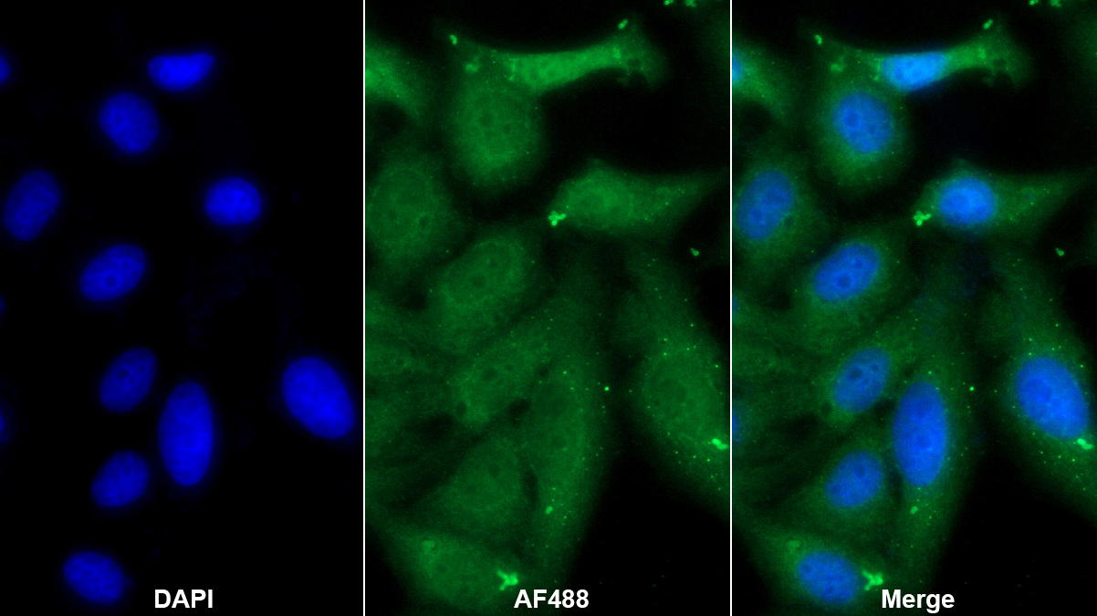 肿瘤易感基因101(TSG101)单克隆抗体