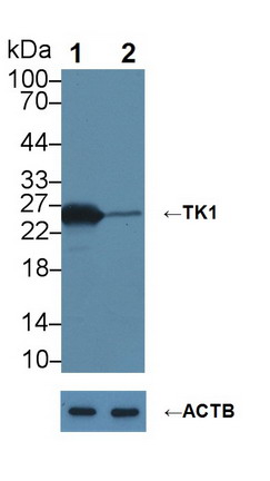 可溶性胸苷激酶1(TK1)单克隆抗体