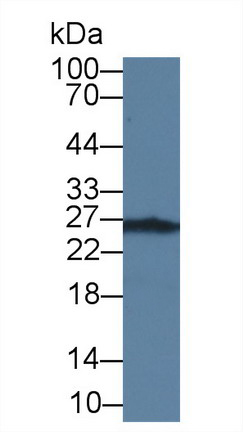 可溶性胸苷激酶1(TK1)单克隆抗体