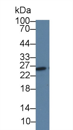 可溶性胸苷激酶1(TK1)单克隆抗体