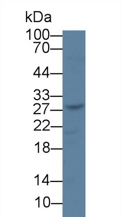 可溶性胸苷激酶1(TK1)单克隆抗体