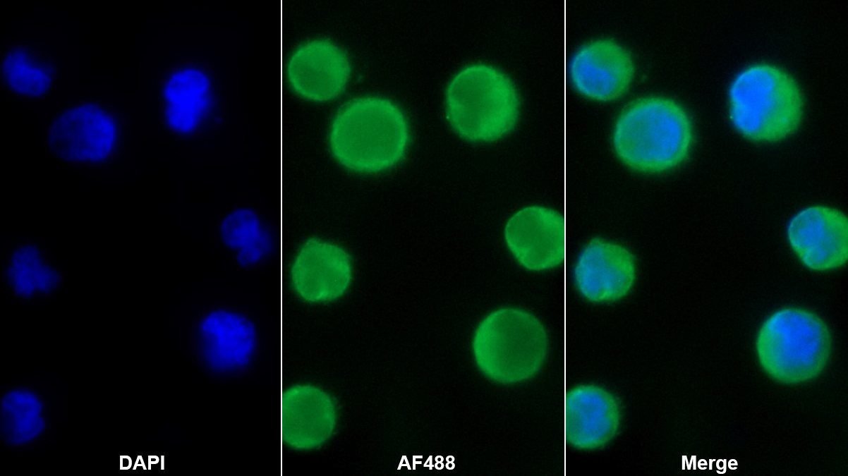 斯鈣素1(STC1)單克隆抗體