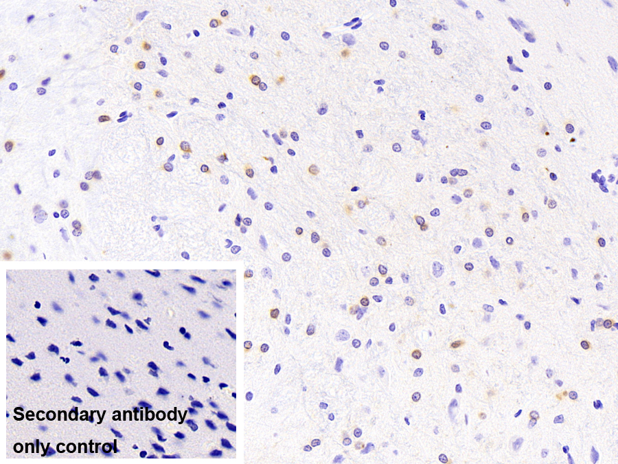 晶狀體蛋白αB(CRYaB)單克隆抗體