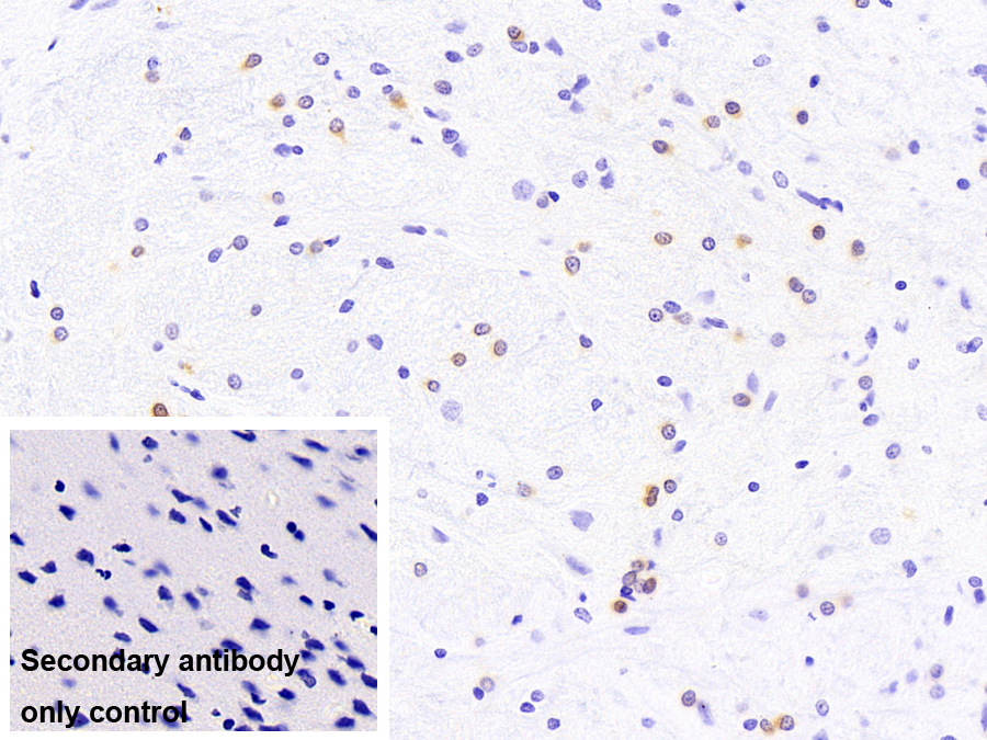 晶狀體蛋白αB(CRYaB)單克隆抗體