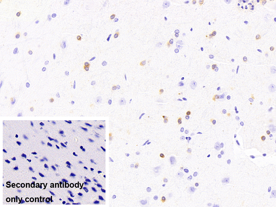 晶狀體蛋白αB(CRYaB)單克隆抗體
