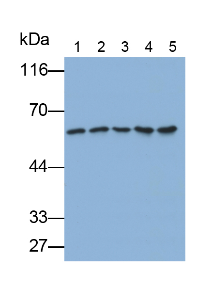癌胚抗原相关细胞粘附分子1(CEACAM1)单克隆抗体