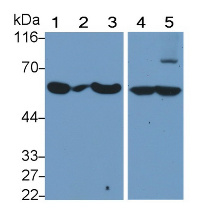 癌胚抗原相關(guān)細(xì)胞粘附分子1(CEACAM1)單克隆抗體