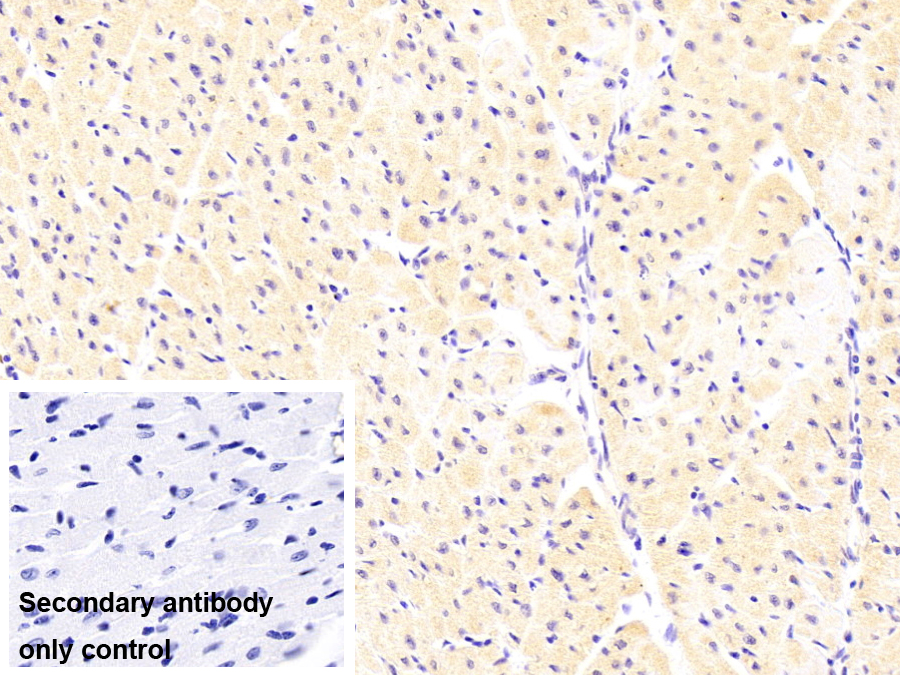 心肌肌球蛋白結(jié)合蛋白C(MYBPC3)單克隆抗體