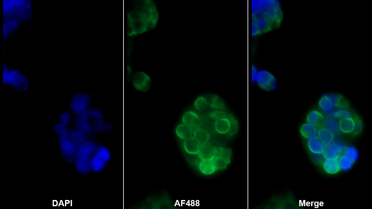輕肽鐵蛋白(FTL)單克隆抗體
