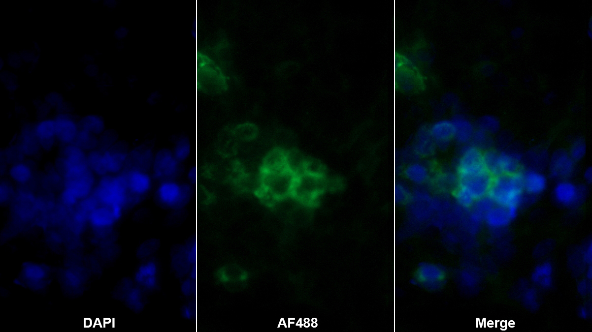 輕肽鐵蛋白(FTL)單克隆抗體
