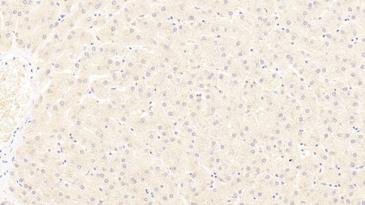 低密度脂蛋白受體相關(guān)蛋白6(LRP6)單克隆抗體