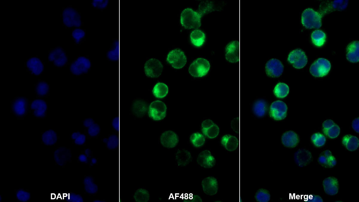 T-细胞表面糖蛋白CD3γ(CD3g)单克隆抗体