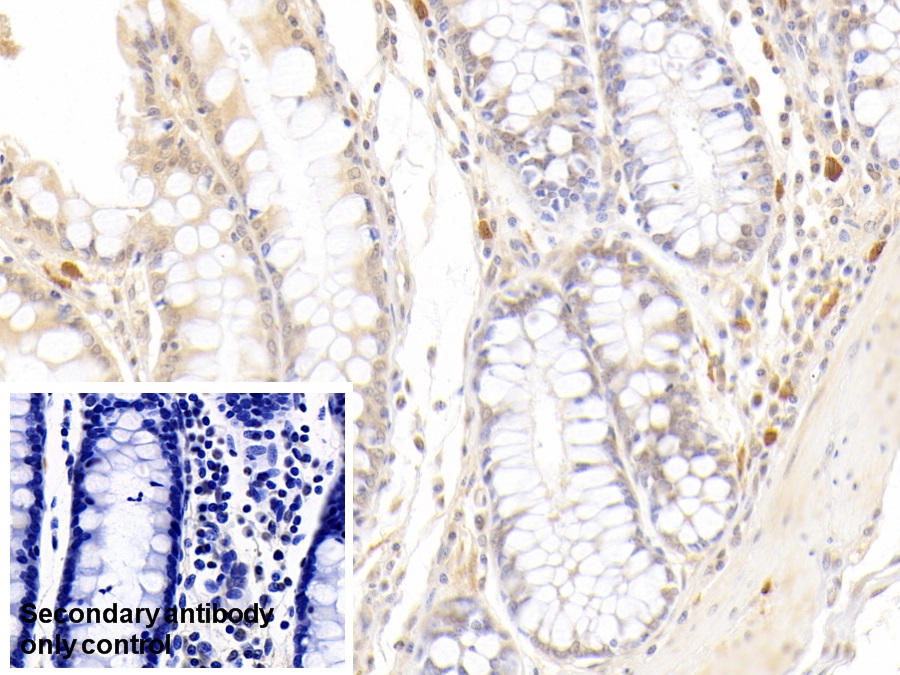 核糖核酸酶A2(RNASE2)單克隆抗體