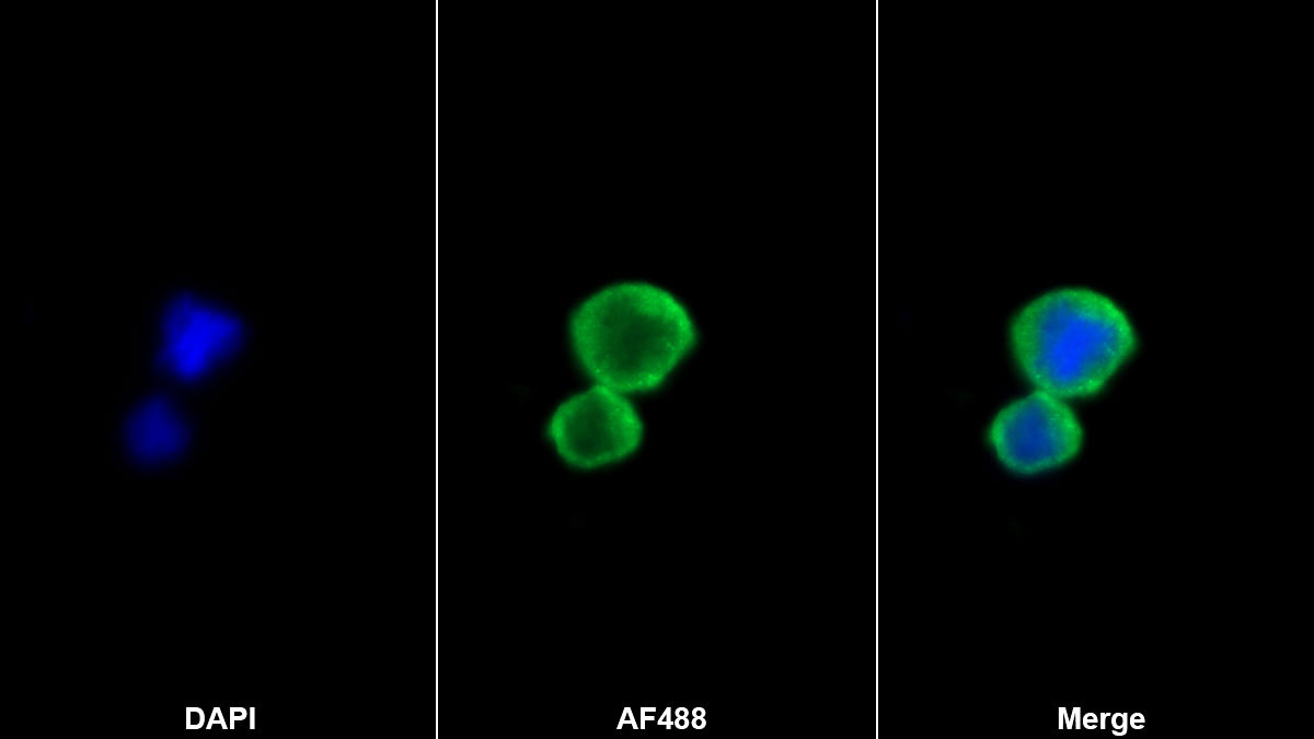 核糖核酸酶A2(RNASE2)单克隆抗体