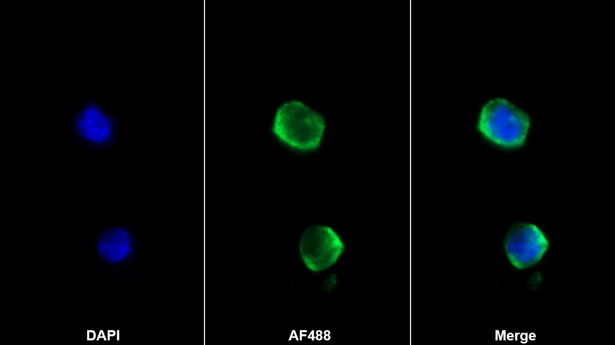 核糖核酸酶A2(RNASE2)單克隆抗體