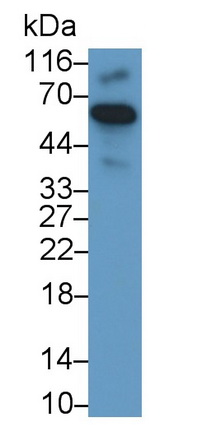 死骨片1(SQSTM1)单克隆抗体