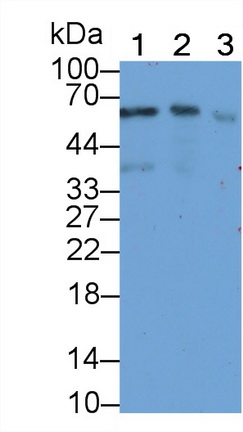 死骨片1(SQSTM1)单克隆抗体
