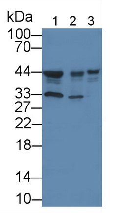 酪蛋白激酶1δ(CSNK1d)单克隆抗体
