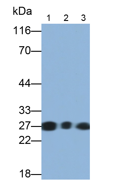 肌球蛋白輕鏈3(MYL3)單克隆抗體