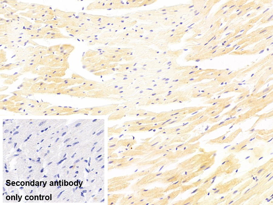 肌球蛋白轻链3(MYL3)单克隆抗体