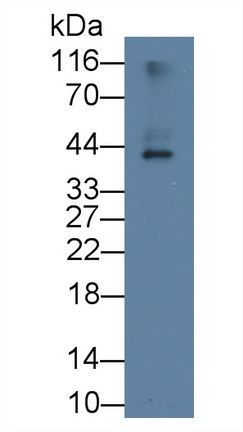 載脂蛋白L2(APOL2)單克隆抗體