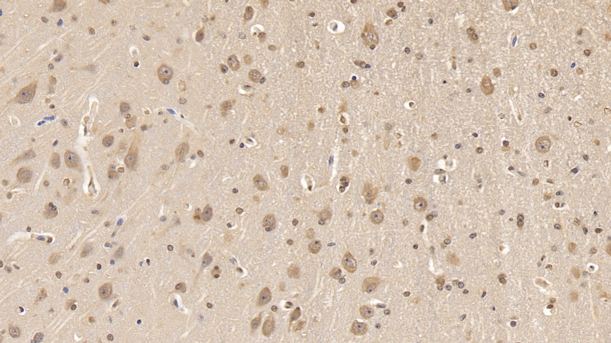 載脂蛋白L2(APOL2)單克隆抗體