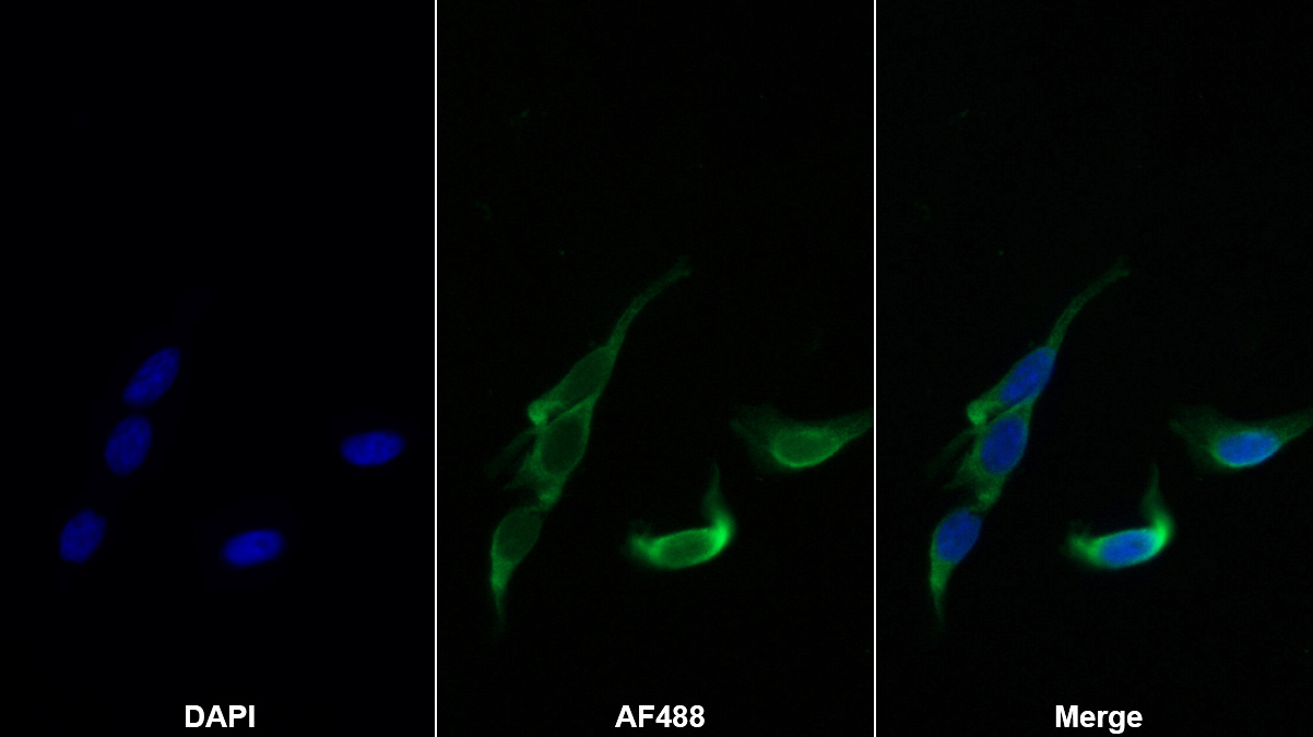 載脂蛋白L2(APOL2)單克隆抗體