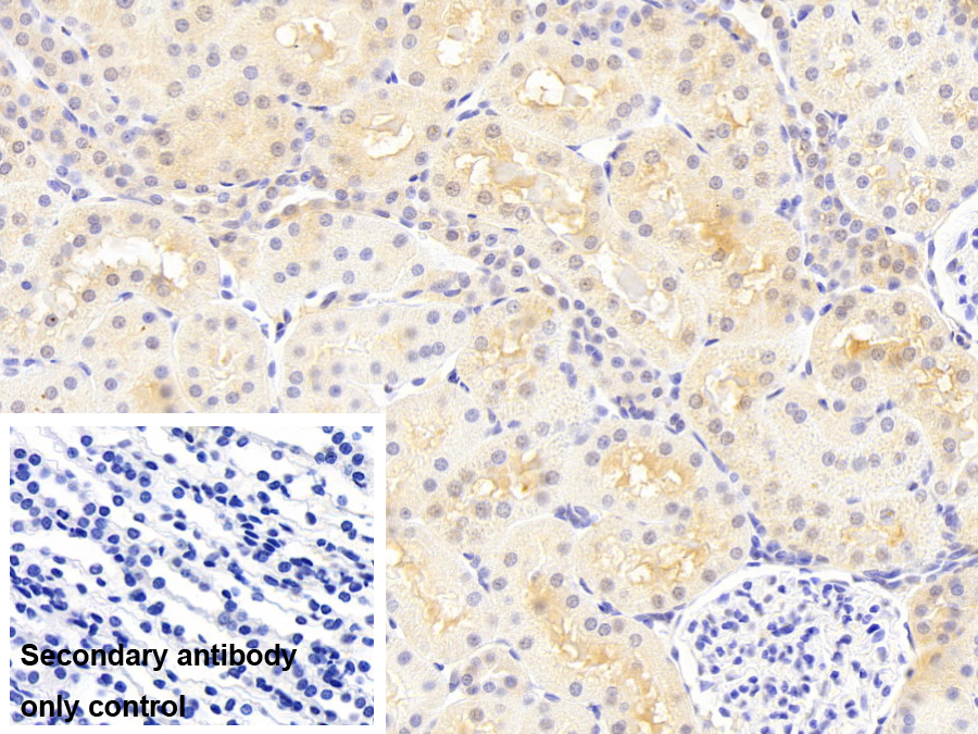 精氨酸酶Ⅱ(Arg2)單克隆抗體