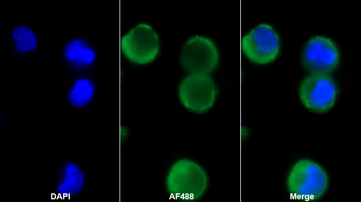 鈉氯協(xié)同轉(zhuǎn)運(yùn)蛋白(NCCT)單克隆抗體