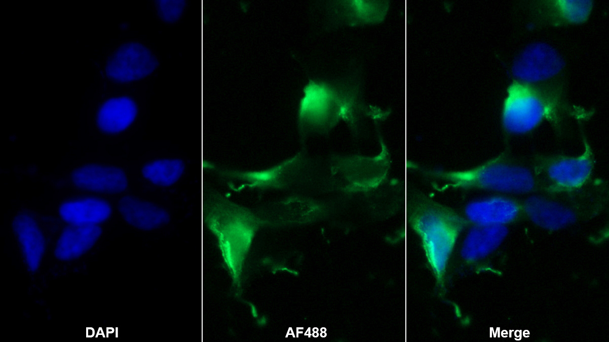 鈉/葡萄糖協(xié)同轉(zhuǎn)運蛋白1(SGLT1)單克隆抗體