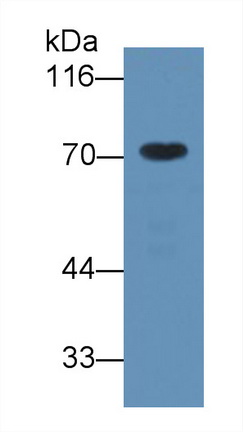 α1-B-糖蛋白(a1BG)單克隆抗體